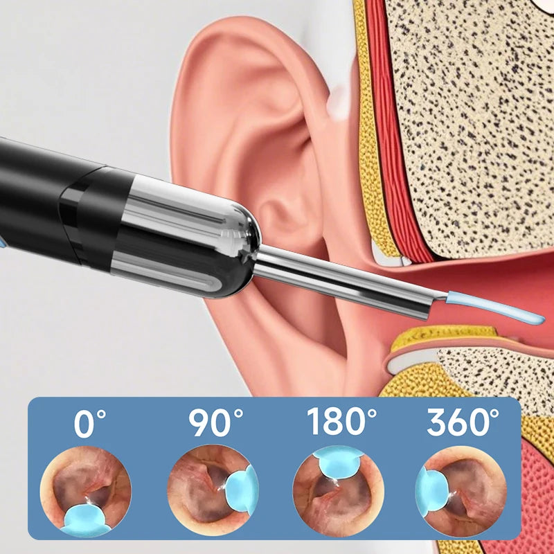 WiFi Visual Ear Cleaner with 1080P HD Camera – Ear Wax Removal Kit with 6 LED Lights, 4.2mm Ear Pick, Waterproof, Compatible with iPhone & Android, Includes Storage Case