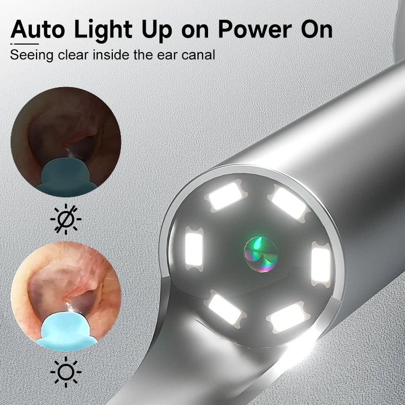 WiFi Visual Ear Cleaner with 1080P HD Camera – Ear Wax Removal Kit with 6 LED Lights, 4.2mm Ear Pick, Waterproof, Compatible with iPhone & Android, Includes Storage Case