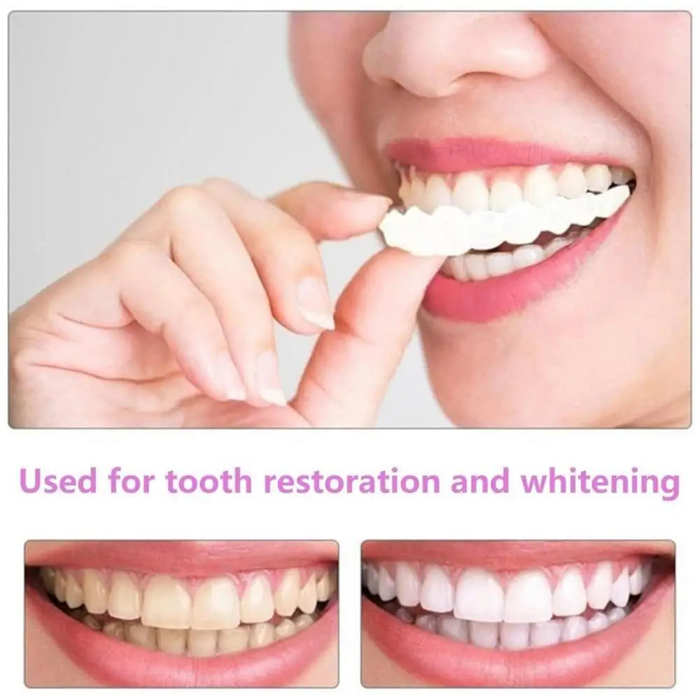 2PCS Temporary Teeth Veneers Cover for Smile Enhancement – Removable Dental Cover for Men and Women