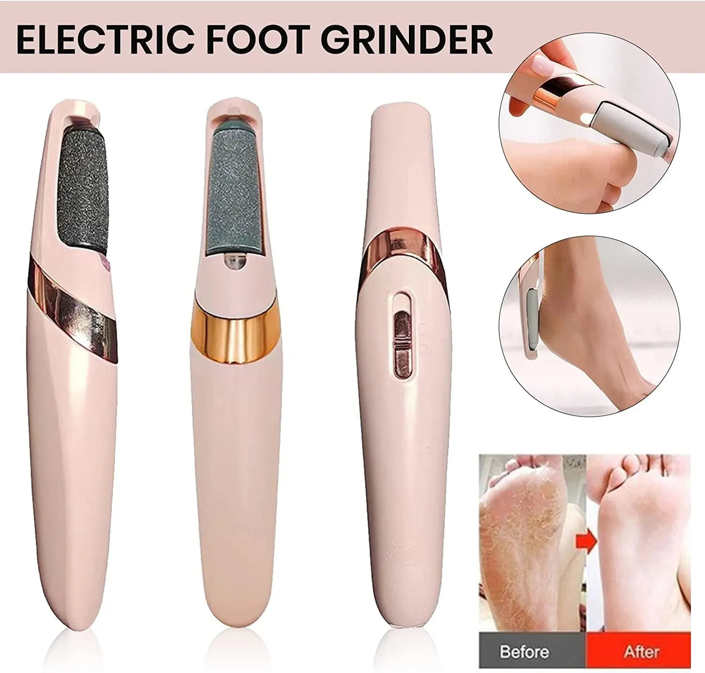 Electric Foot Grinder – Pink Electronic Callus Remover & Skin Smoother, Heel & Foot Care Tool