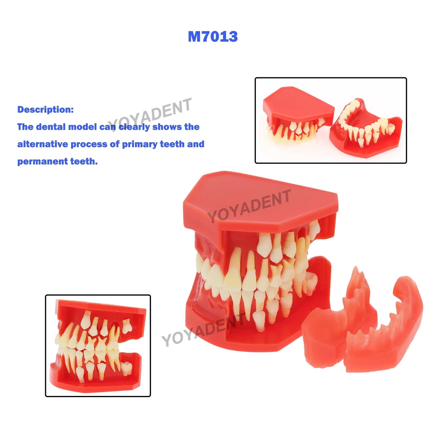 Dental Teeth Teaching Model Set – Typodont Orthodontic Practice Model for Dental Education, Study & Demonstration