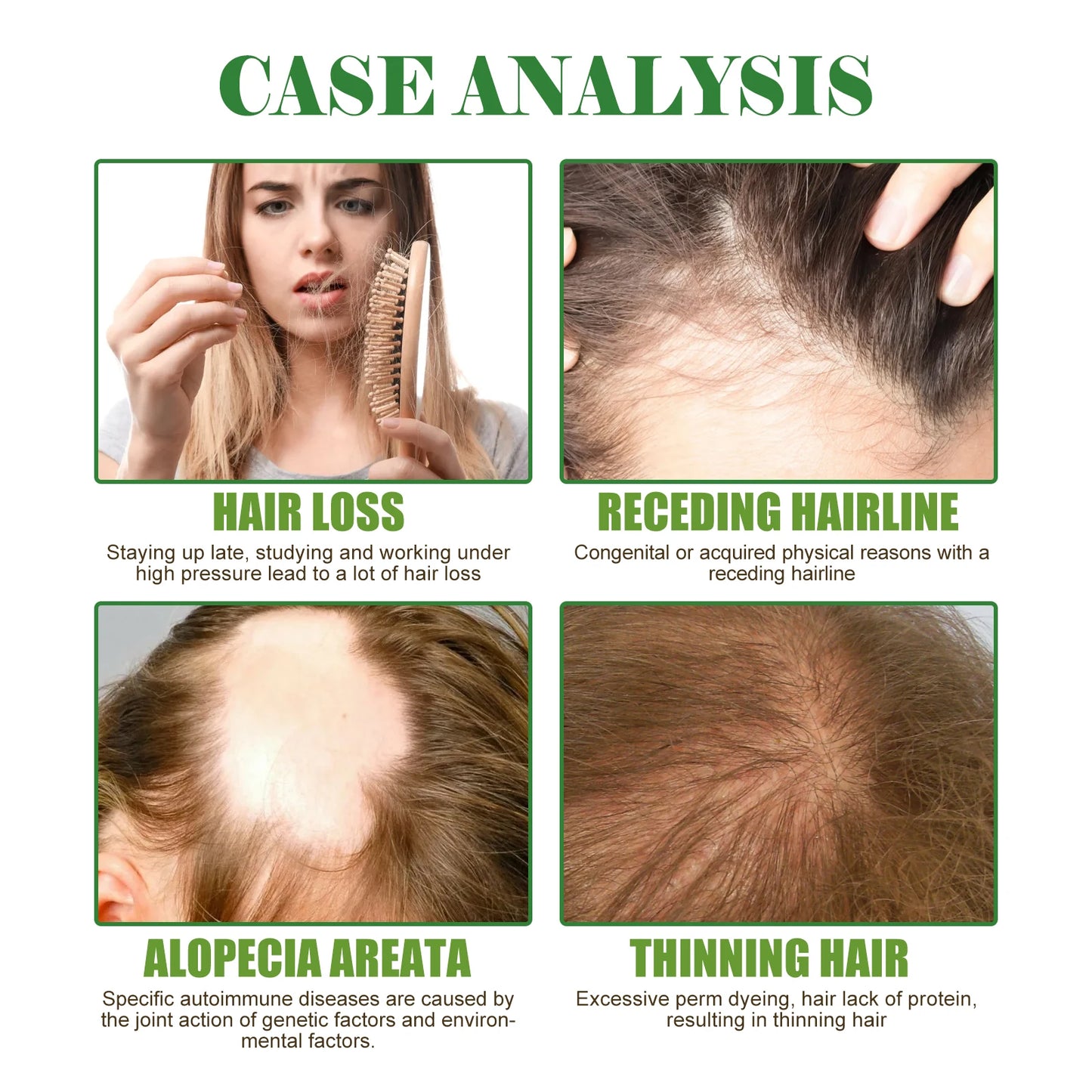Rosemary Hair Growth Oil with Brush – Nourishing Hair Care for Strong Roots, Healthy Scalp, and Dense Hair
