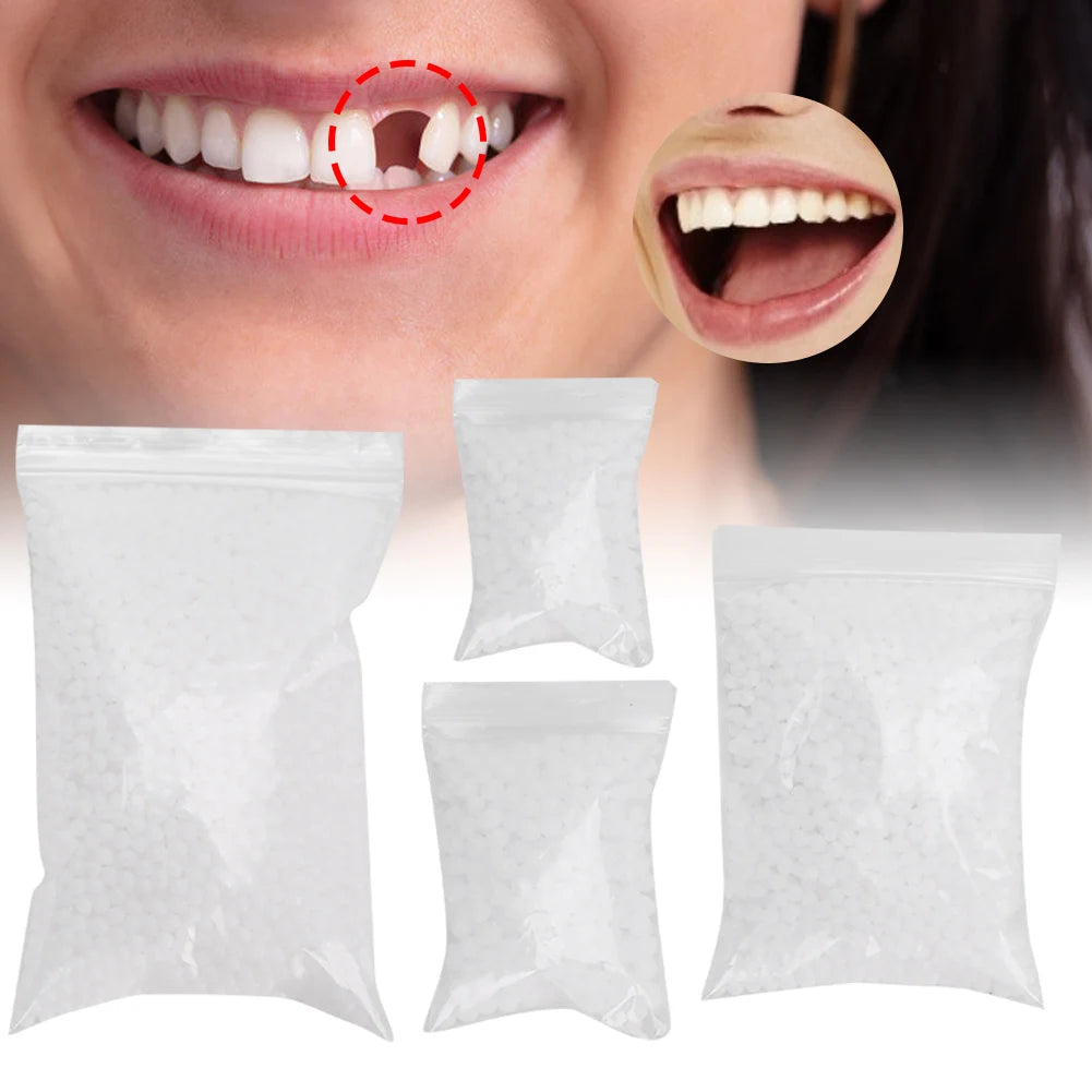 Temporary Tooth Repair Beads for Broken or Missing Teeth – Dental Filling Material