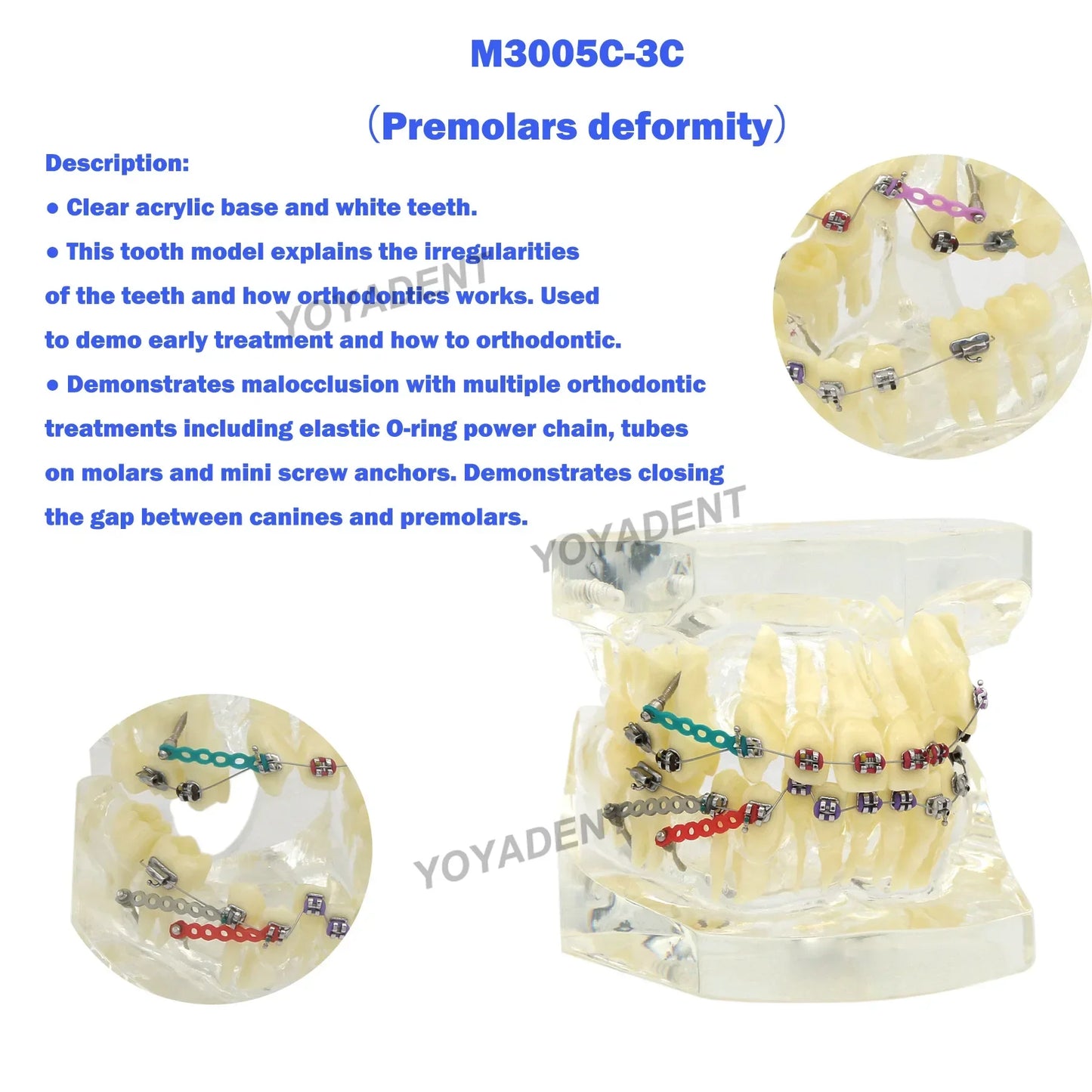 Dental Teeth Teaching Model Set – Typodont Orthodontic Practice Model for Dental Education, Study & Demonstration
