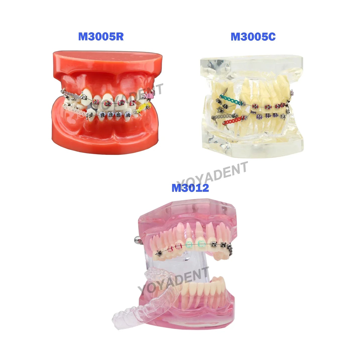 Dental Teeth Teaching Model Set – Typodont Orthodontic Practice Model for Dental Education, Study & Demonstration
