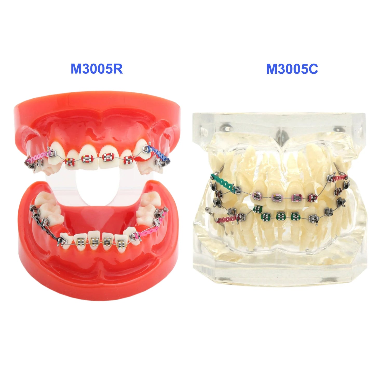 Dental Teeth Teaching Model Set – Typodont Orthodontic Practice Model for Dental Education, Study & Demonstration