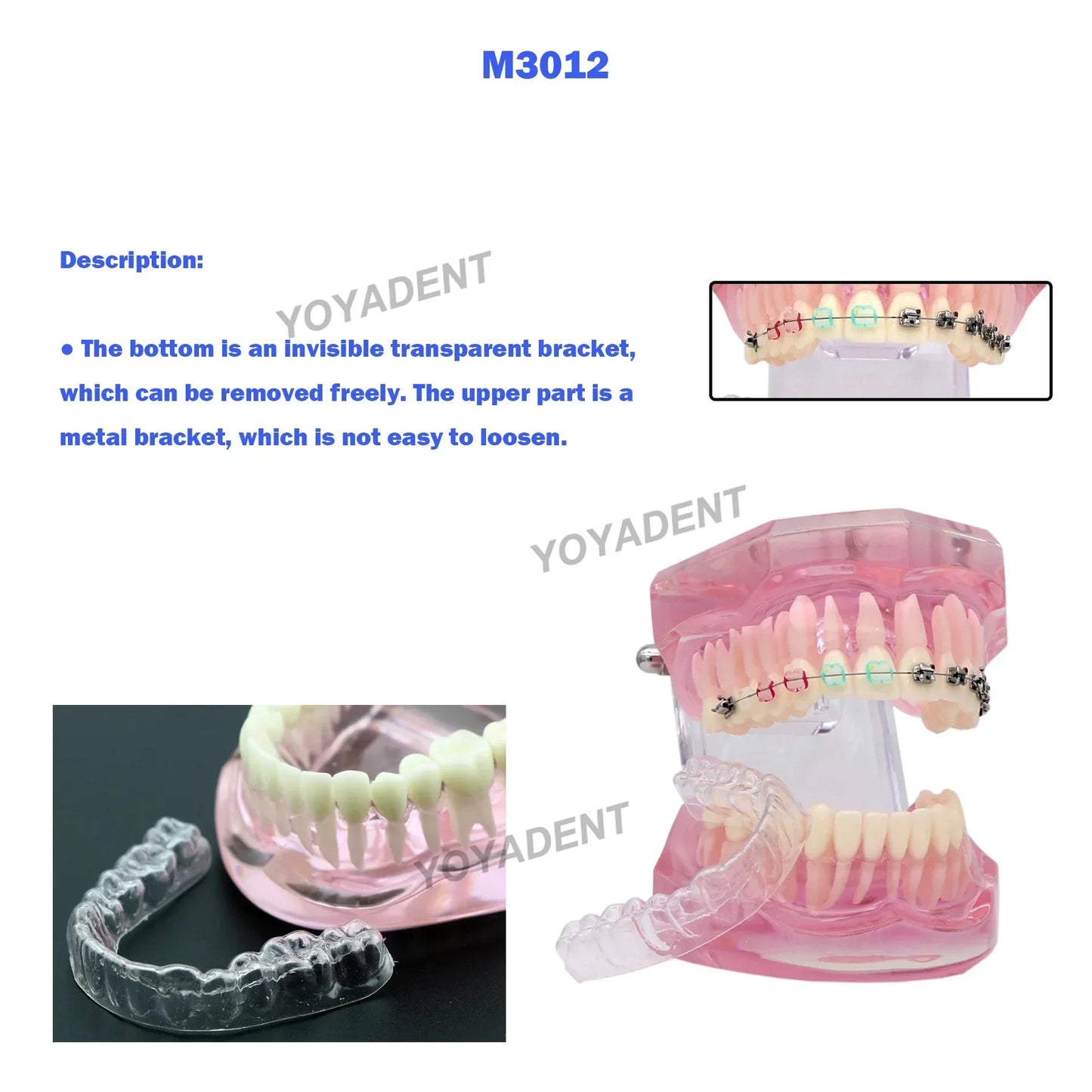 Dental Teeth Teaching Model Set – Typodont Orthodontic Practice Model for Dental Education, Study & Demonstration