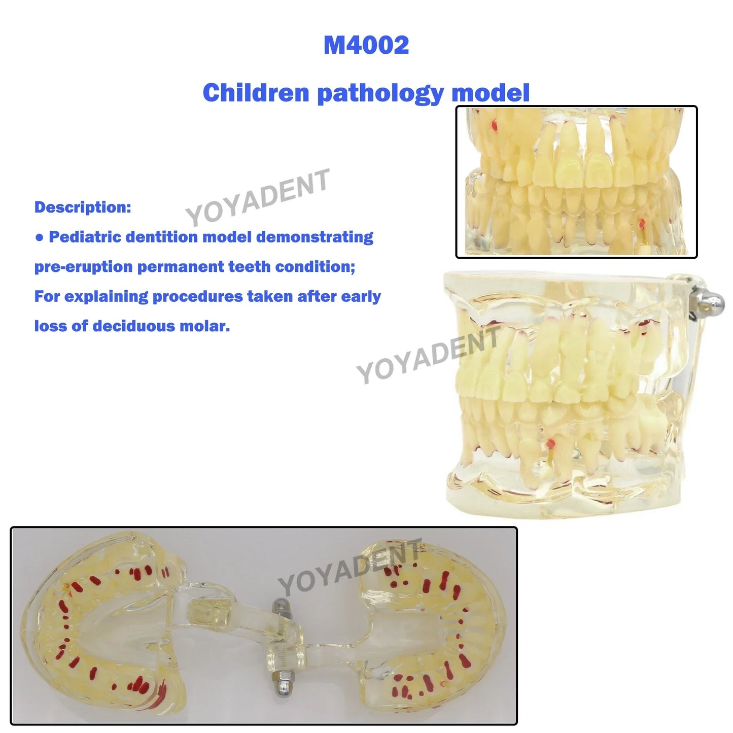 Dental Teeth Teaching Model Set – Typodont Orthodontic Practice Model for Dental Education, Study & Demonstration