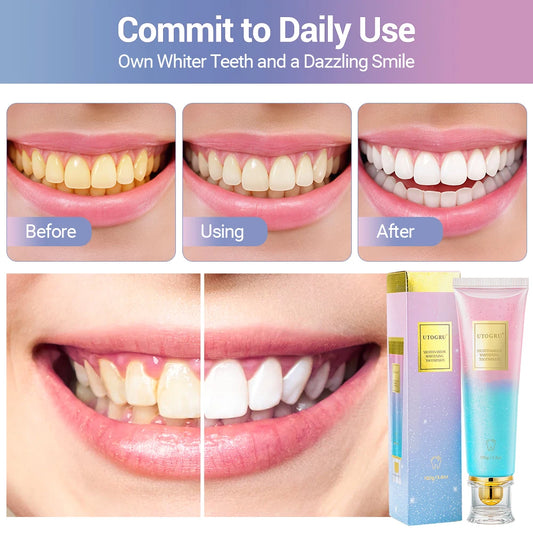 Nicotinamide Whitening Toothpaste – Deep Clean Formula for Stain Removal, Plaque Control & Fresh Breath | Advanced Oral Care 100g