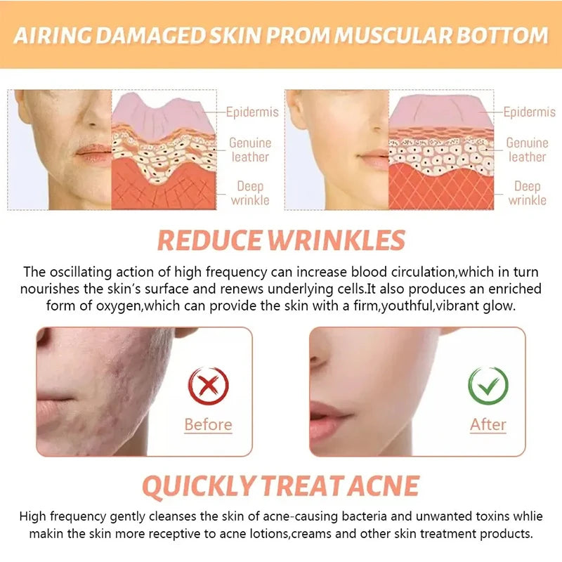 4-in-1 High-Frequency Facial Wand – Galvanic Therapy Tool for Acne, Anti-Aging, Hair Growth & Skin Care