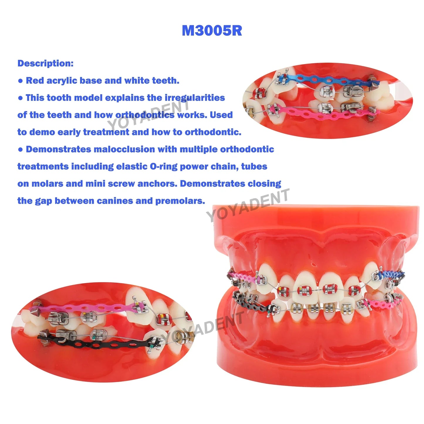 Dental Teeth Teaching Model Set – Typodont Orthodontic Practice Model for Dental Education, Study & Demonstration