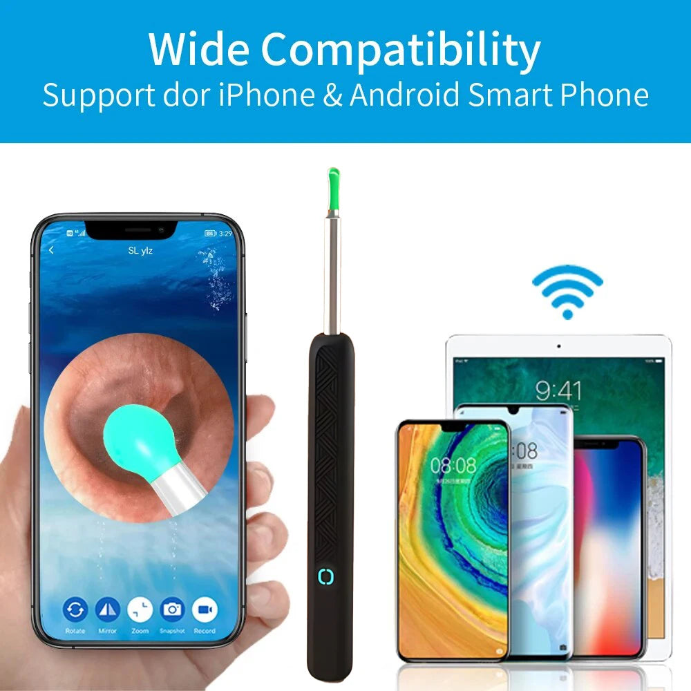1080P HD Visual Ear Cleaner with Camera – Smart Otoscope Wax Removal Tool
