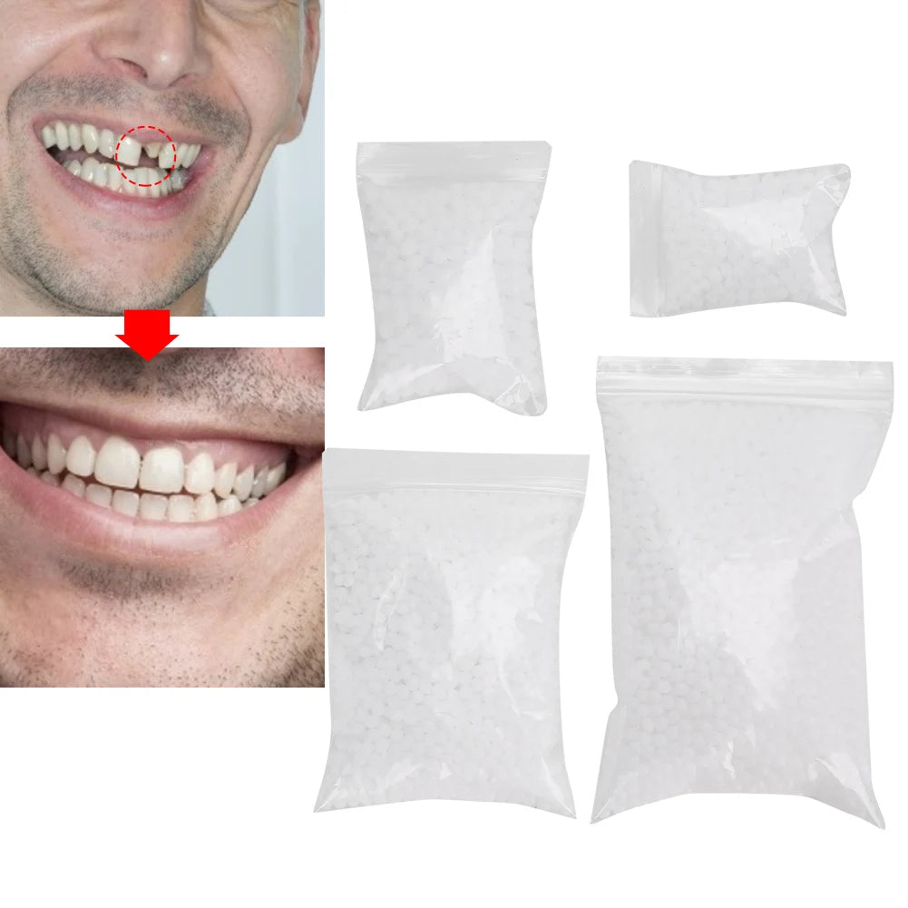 Temporary Tooth Repair Beads for Broken or Missing Teeth – Dental Filling Material