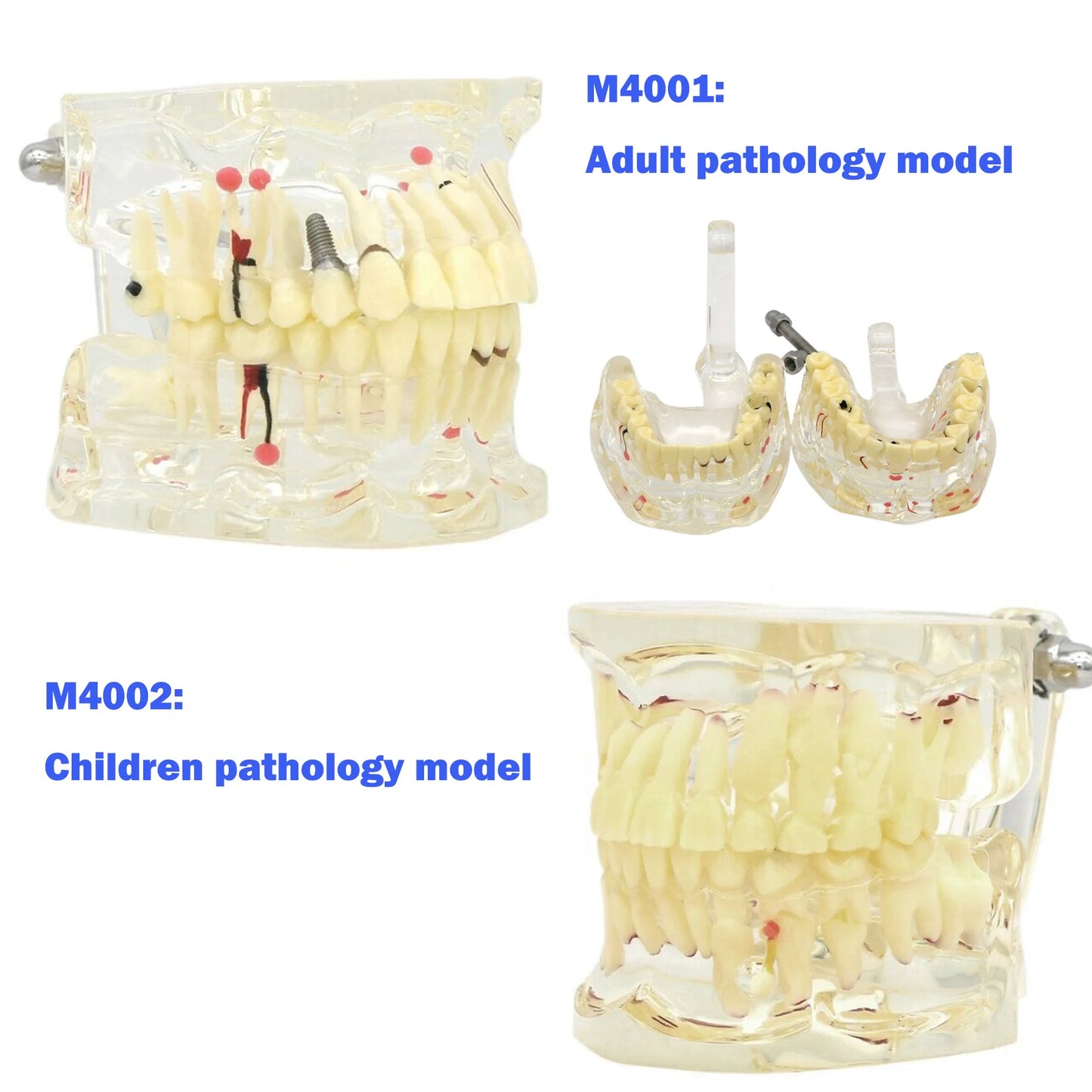 Dental Teeth Teaching Model Set – Typodont Orthodontic Practice Model for Dental Education, Study & Demonstration