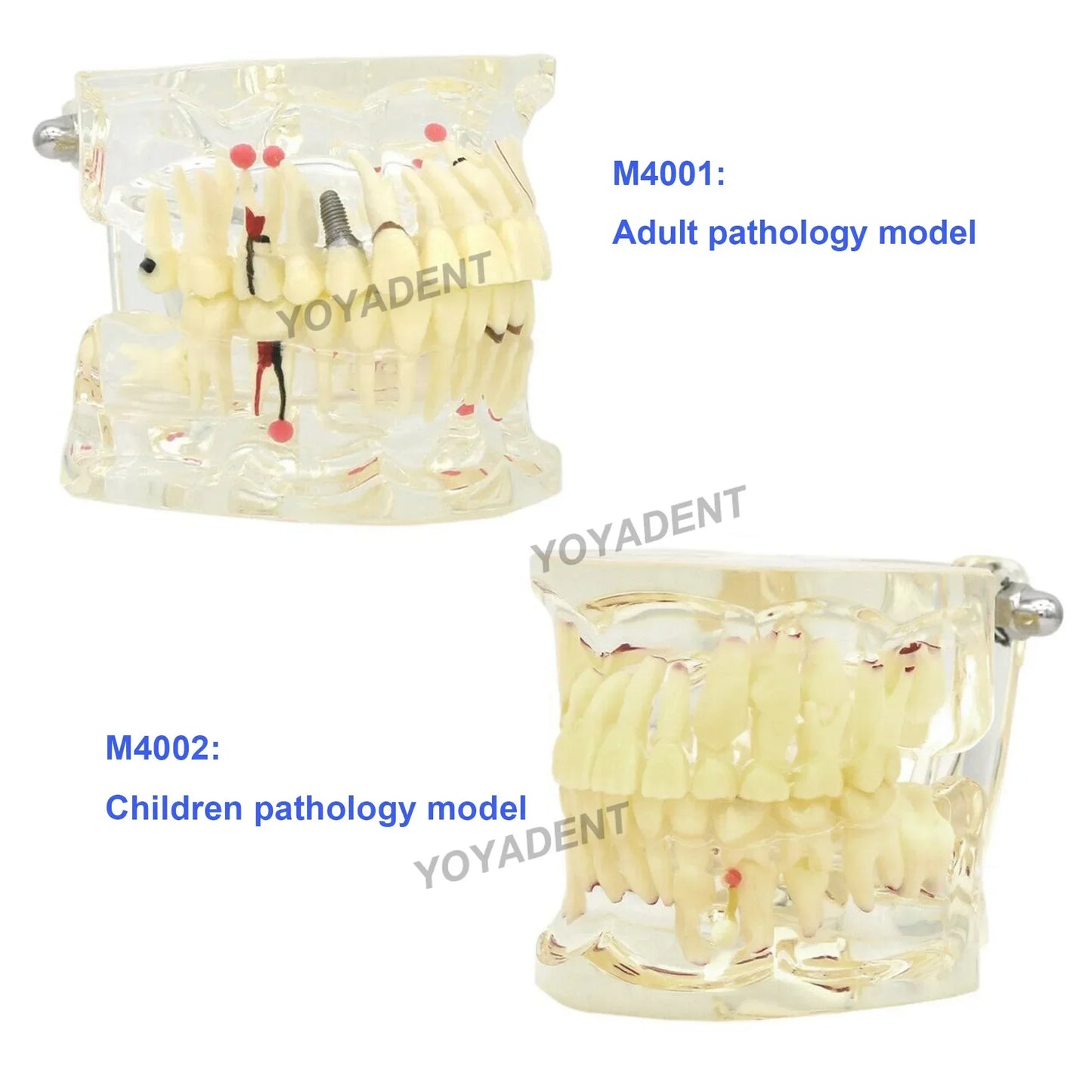 Dental Teeth Teaching Model Set – Typodont Orthodontic Practice Model for Dental Education, Study & Demonstration