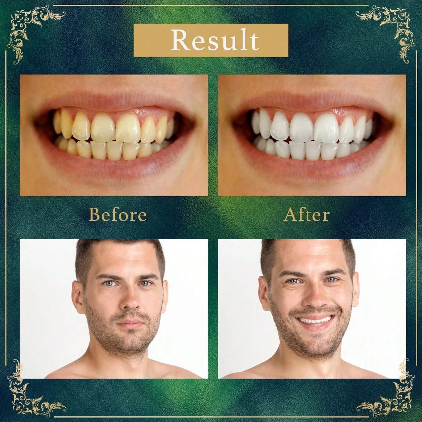 Natural Miswak Tooth Cleaning Stick – Portable Traditional Herbal Toothbrush