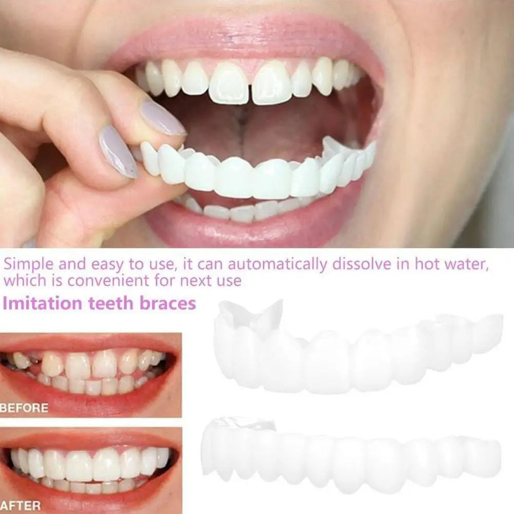 2PCS Temporary Teeth Veneers Cover for Smile Enhancement – Removable Dental Cover for Men and Women