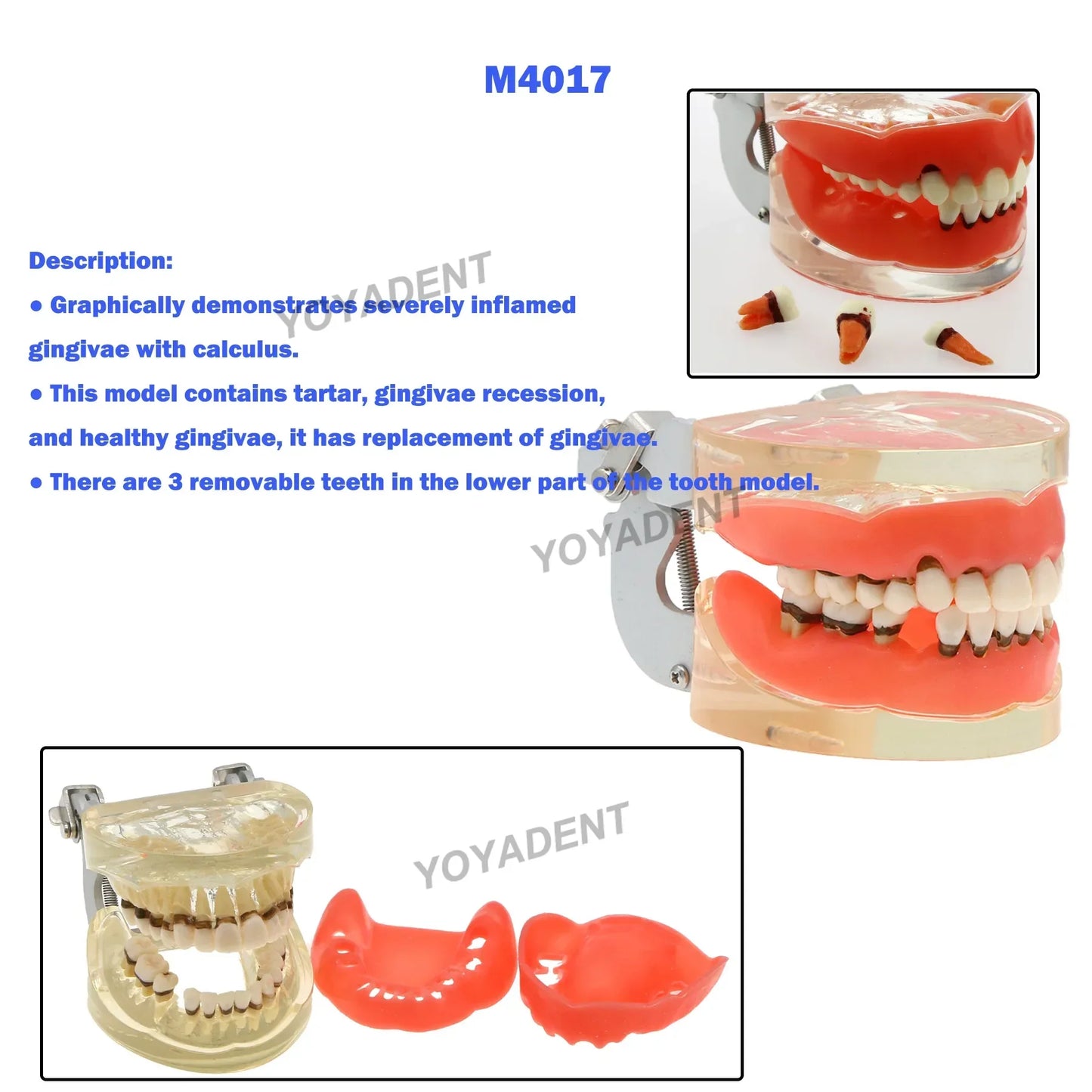 Dental Teeth Teaching Model Set – Typodont Orthodontic Practice Model for Dental Education, Study & Demonstration
