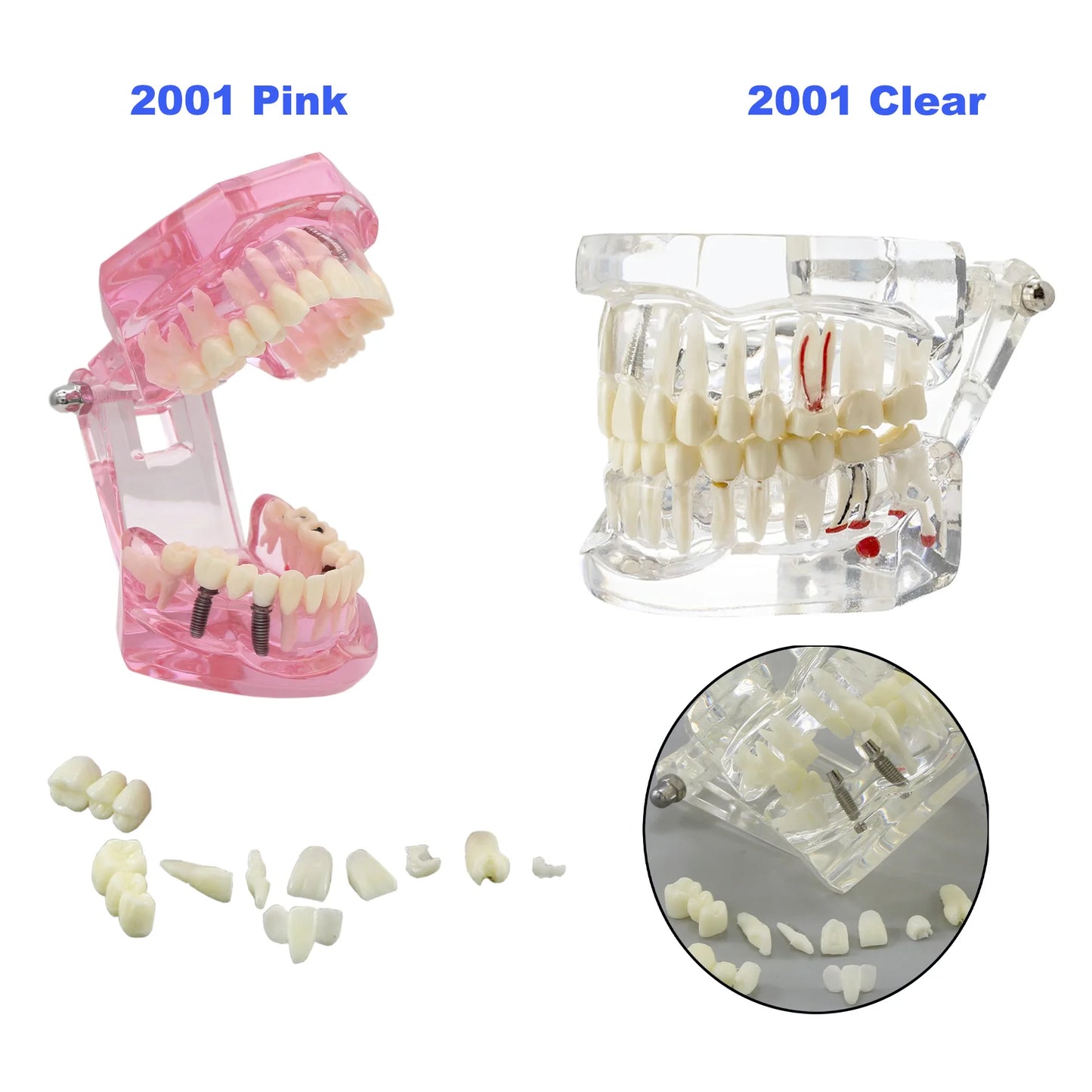 Dental Teeth Teaching Model Set – Typodont Orthodontic Practice Model for Dental Education, Study & Demonstration