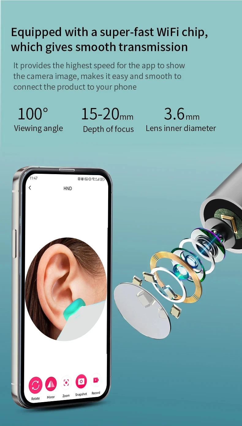 1080P HD Visual Ear Cleaner with Camera – Smart Otoscope Wax Removal Tool