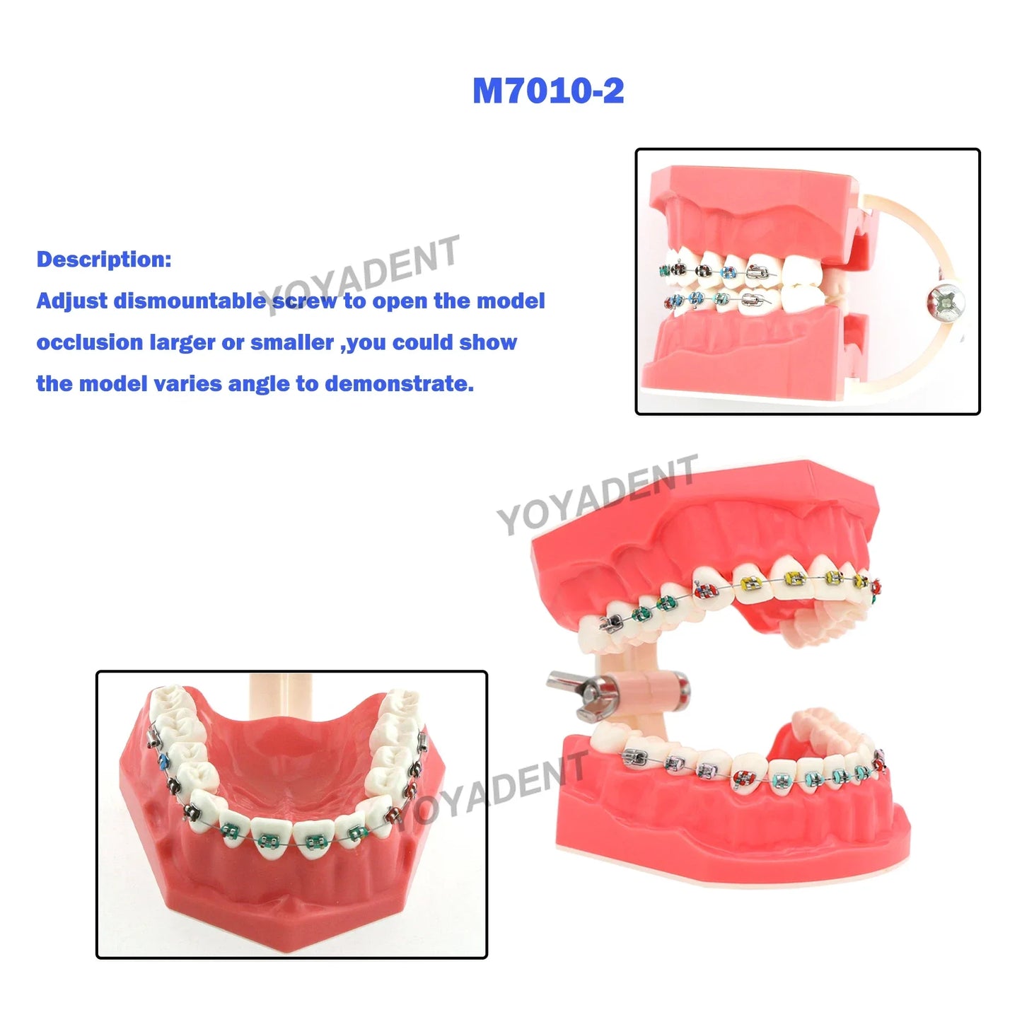 Dental Teeth Teaching Model Set – Typodont Orthodontic Practice Model for Dental Education, Study & Demonstration