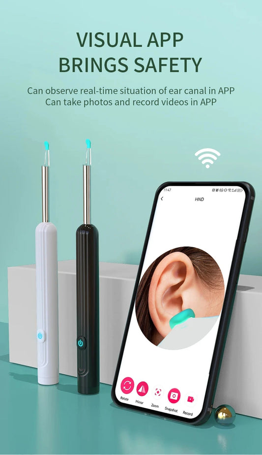 1080P HD Visual Ear Cleaner with Camera – Smart Otoscope Wax Removal Tool