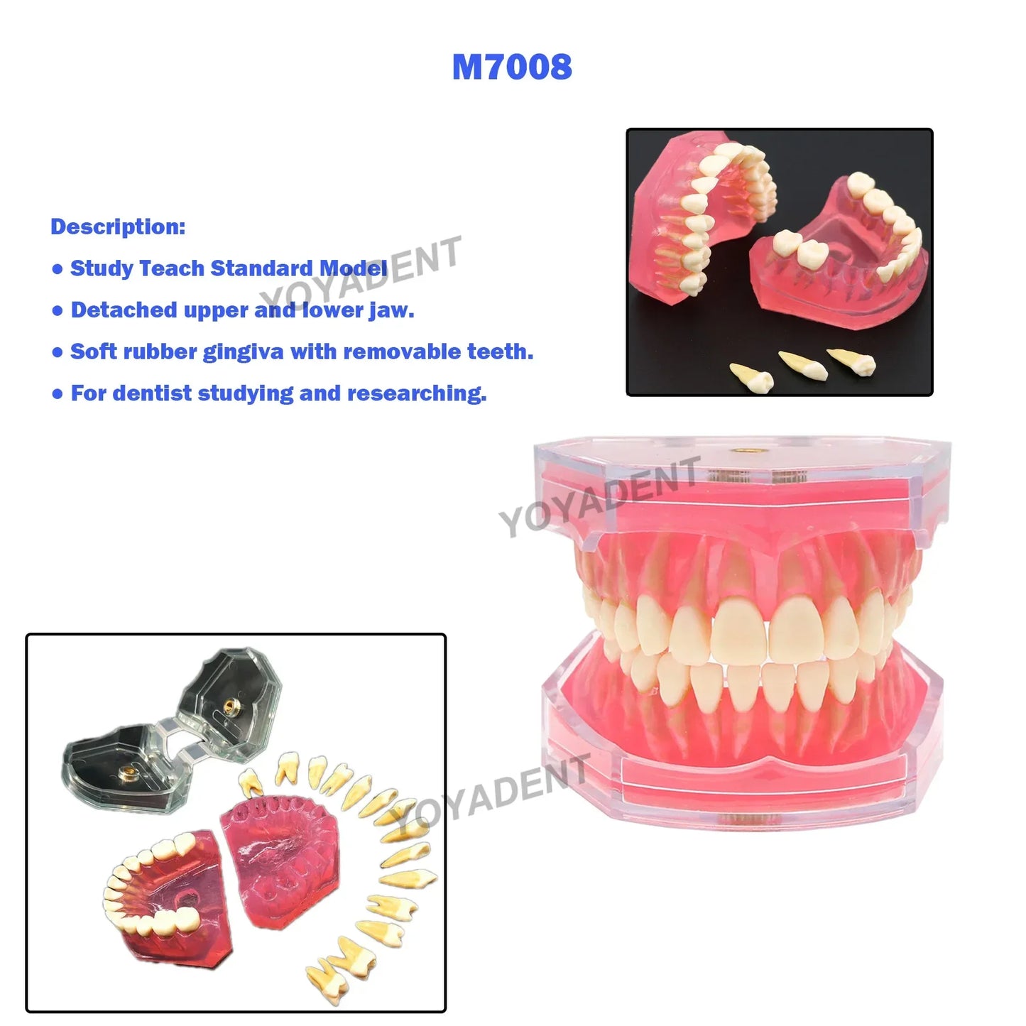 Dental Teeth Teaching Model Set – Typodont Orthodontic Practice Model for Dental Education, Study & Demonstration