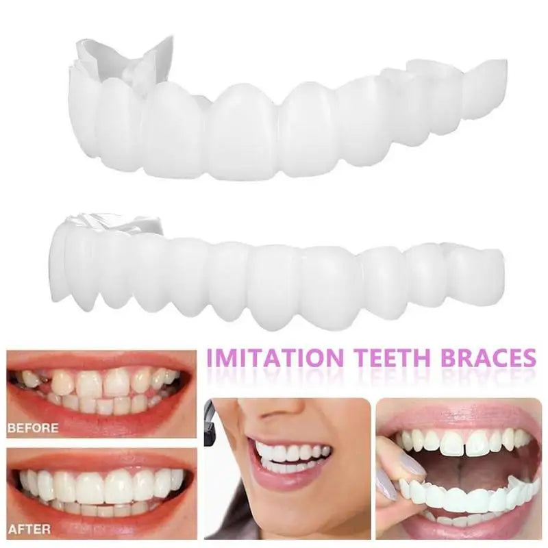 2PCS Temporary Teeth Veneers Cover for Smile Enhancement – Removable Dental Cover for Men and Women
