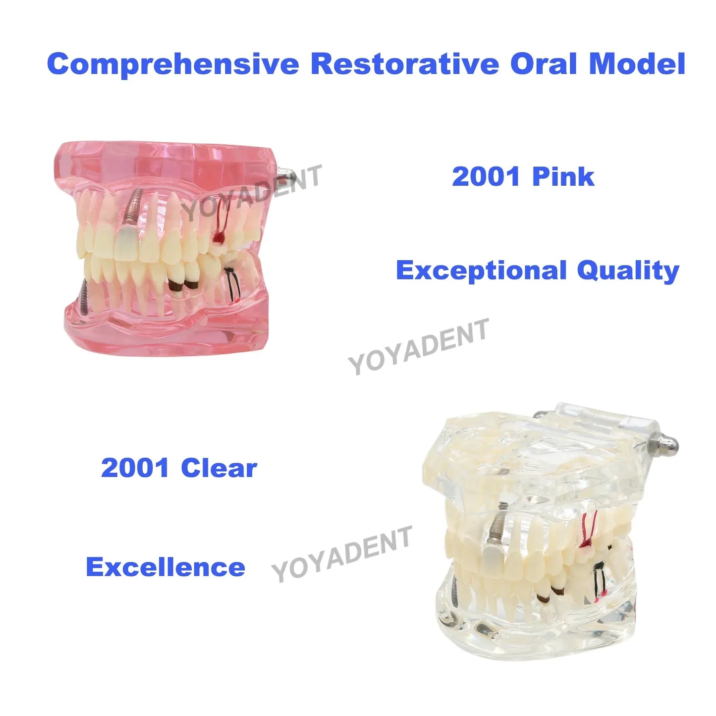 Dental Teeth Teaching Model Set – Typodont Orthodontic Practice Model for Dental Education, Study & Demonstration