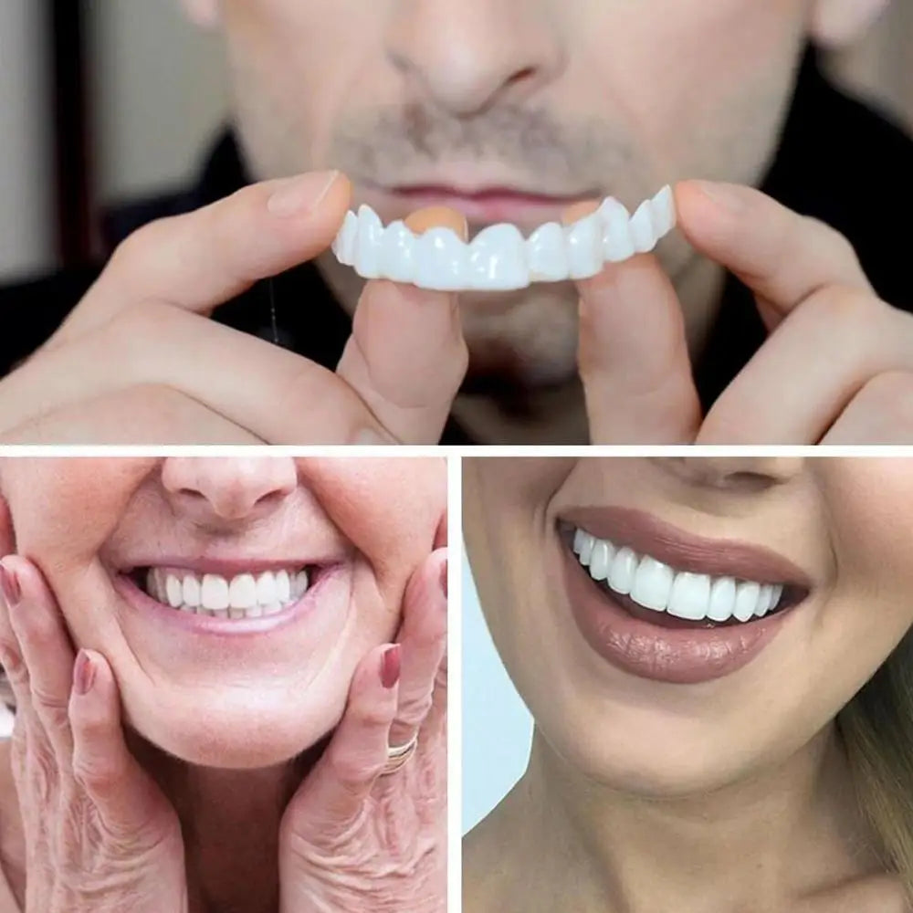 2PCS Temporary Teeth Veneers Cover for Smile Enhancement – Removable Dental Cover for Men and Women