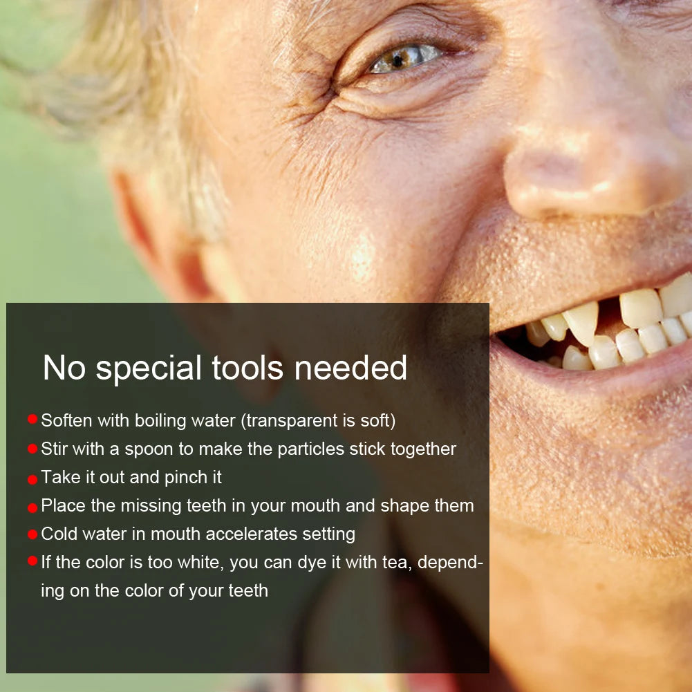 Temporary Tooth Repair Beads for Broken or Missing Teeth – Dental Filling Material