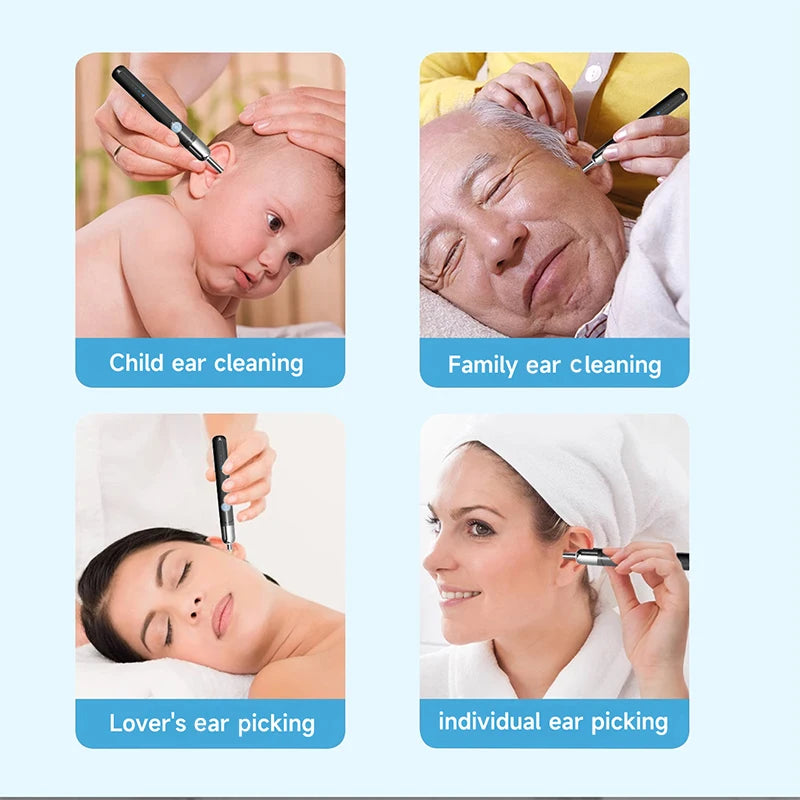 WiFi Visual Ear Cleaner with 1080P HD Camera – Ear Wax Removal Kit with 6 LED Lights, 4.2mm Ear Pick, Waterproof, Compatible with iPhone & Android, Includes Storage Case