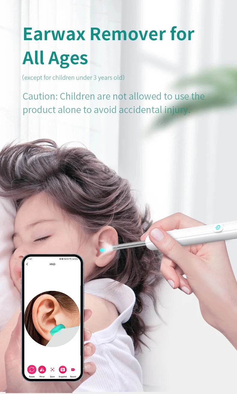 1080P HD Visual Ear Cleaner with Camera – Smart Otoscope Wax Removal Tool